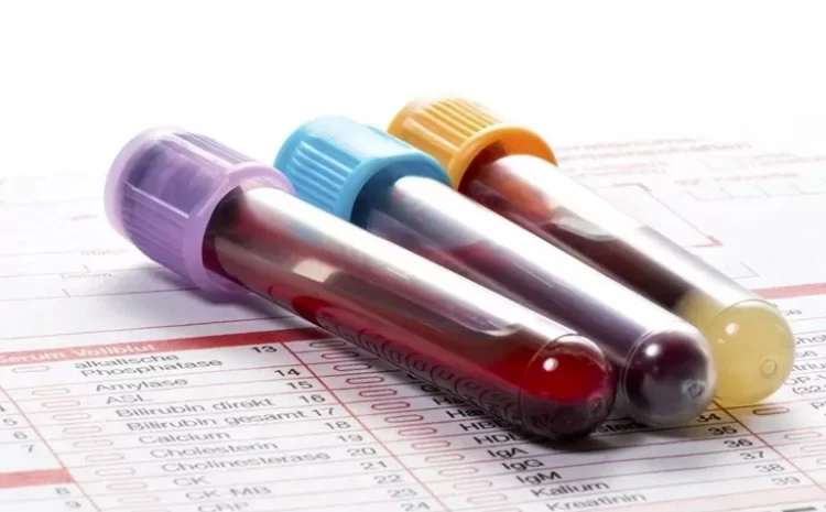 Genetic Link Between Blood Test Results And Mental Health Disorders
