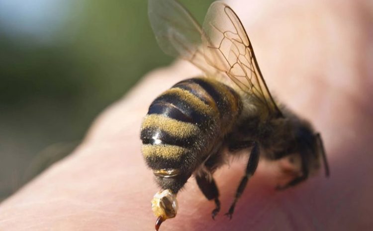 If A Bee Bites Us, Will It Really Die?