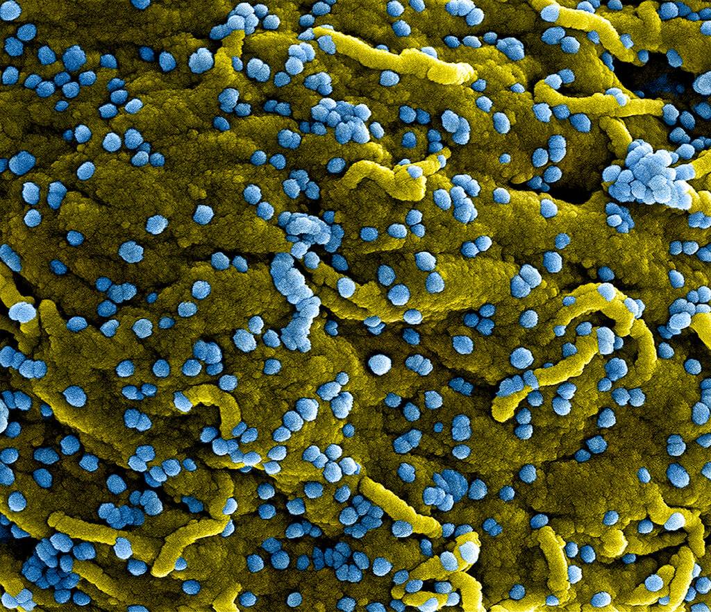Marburg virus particles