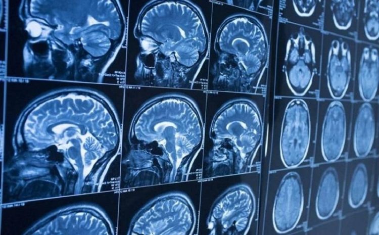 MRI Technology Can Reveal The Relationship Between Brain Activity And Psychological Characteristics